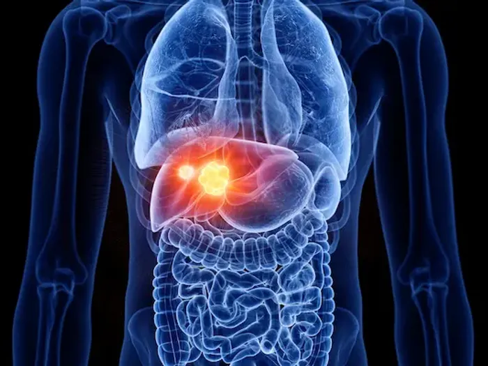 What Leads To Signs Of Liver Cancer And